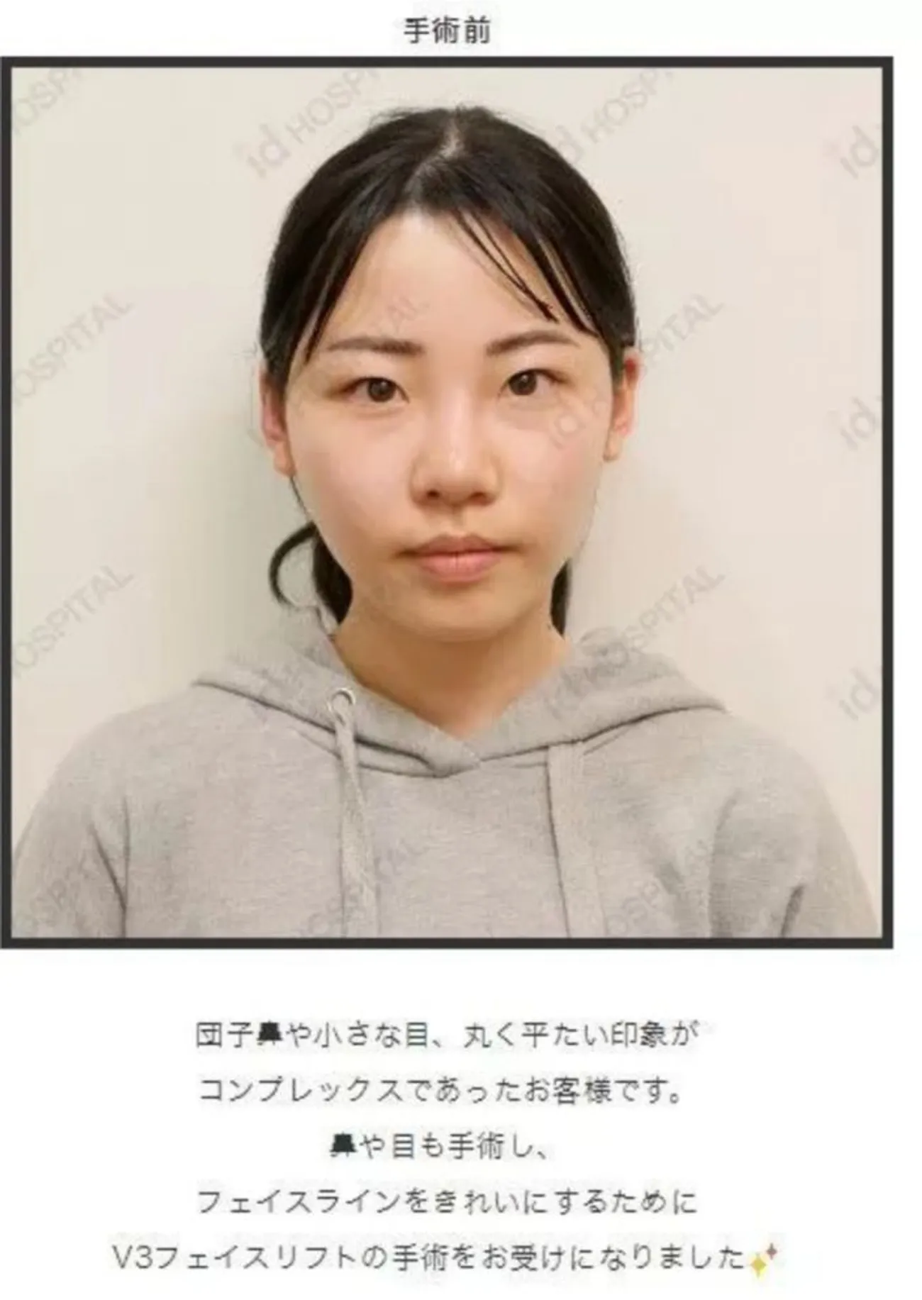 「深田咏美」暗黑界AV霸主！7件奇闻轶事＆奋斗史介绍，整型前后落差超大？